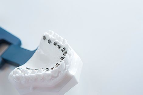 Kinder Zahnzusatzversicherung