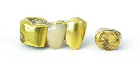 zab-vorsorge-zahnersatz.jpg zab-vorsorge-zahnersatz.jpg