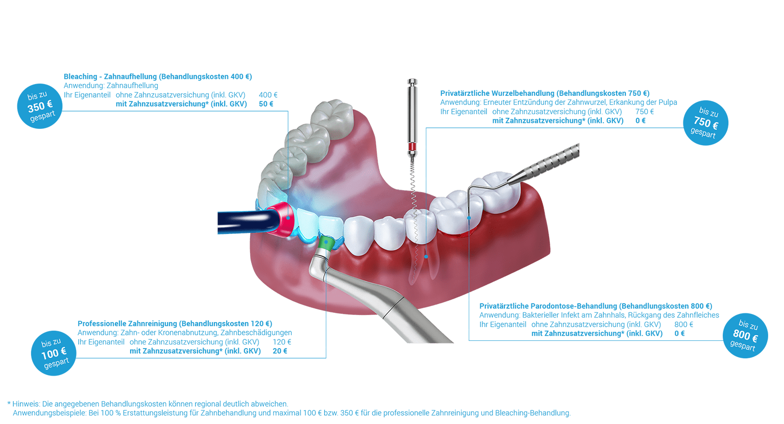 erstattungsbeispiele-zahnbehandlung-beispiel-100.png