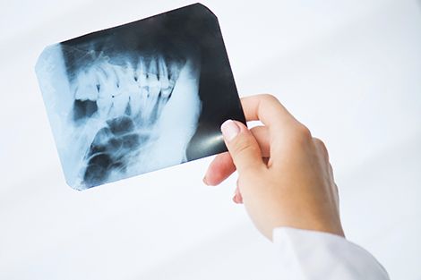 Fehlender Zahn  im Gebiss