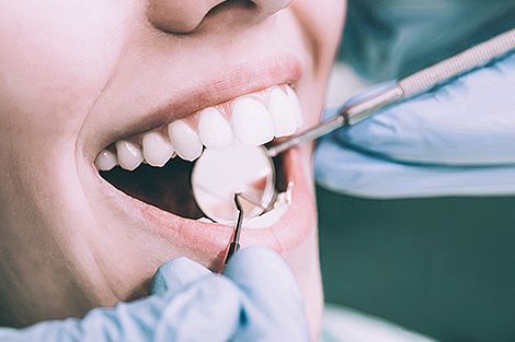 Zahnzusatzversicherung und Bonusheft